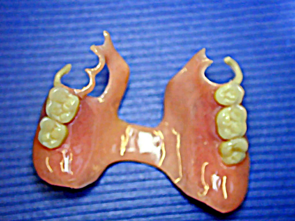 acetal