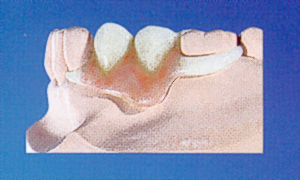 acetal
