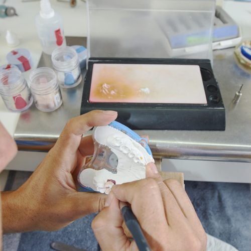 laboratoire dentaire